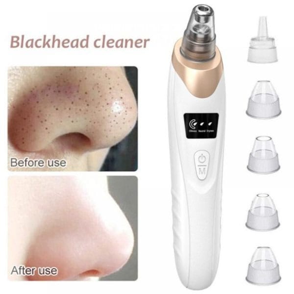 Electric Blackhead Remover  Vacuum Acne & Pore Cleaner  5 Heads Suction Machine  Skin Care & Exfoliating Tool